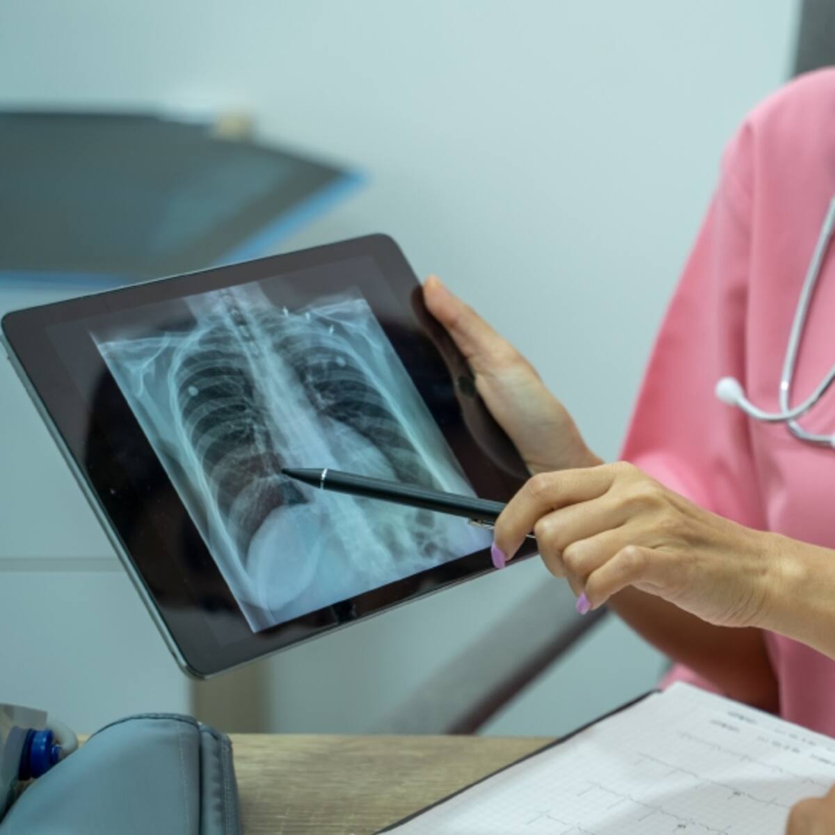 Alerta por tuberculosis en Chile: confirman tres contagios en Biobío y Coquimbo y activan protocolos de seguridad