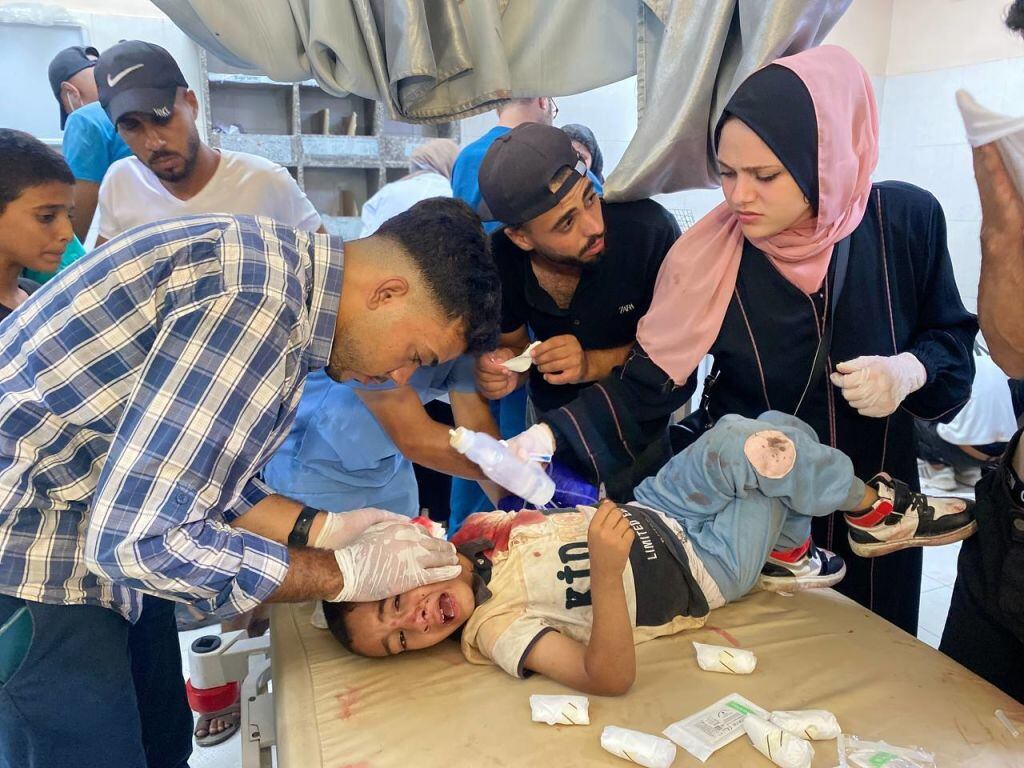 Un niño palestino herido es atendido en un hospital en Gaza luego de que Israel atacara una escuela donde se protegían refugiados en Jan Yunis.
