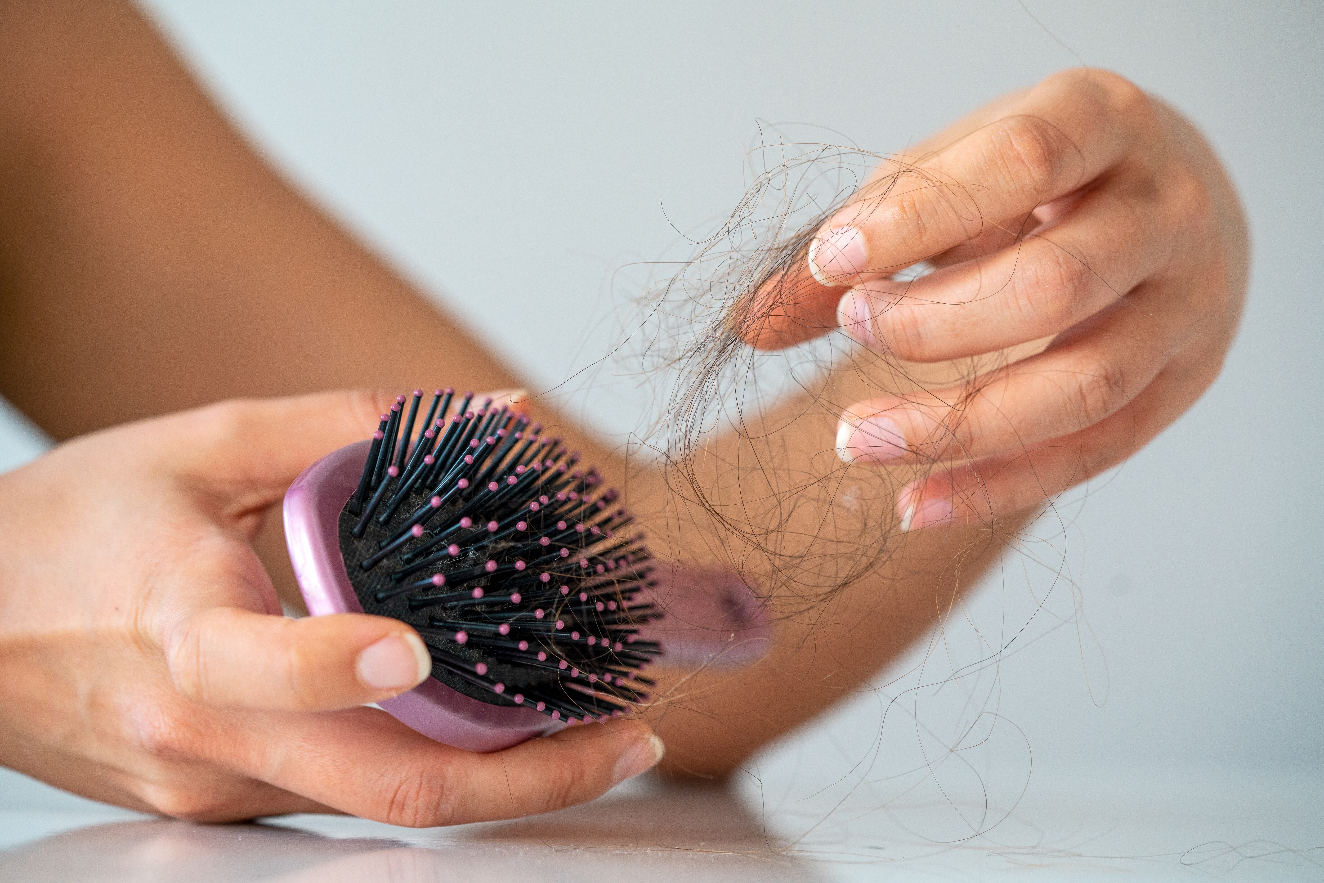 Aumenta la caída del cabello en Chile: esta es la causa que explicaría el alza de casos en mujeres