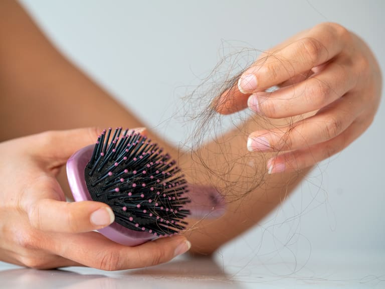 Aumenta la caída del cabello en Chile: esta es la causa que explicaría el alza de casos en mujeres