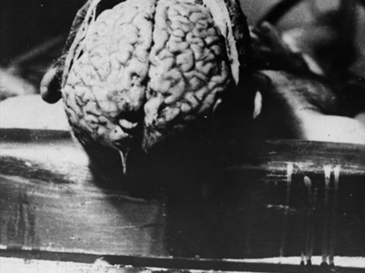 ¿Cómo ser útil después de la muerte? Donar tu cuerpo a la ciencia es una opción