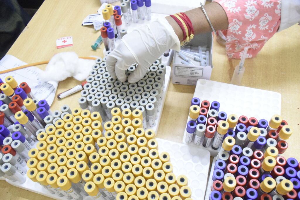 Laboratorio de India revisa test para detectar la malaria