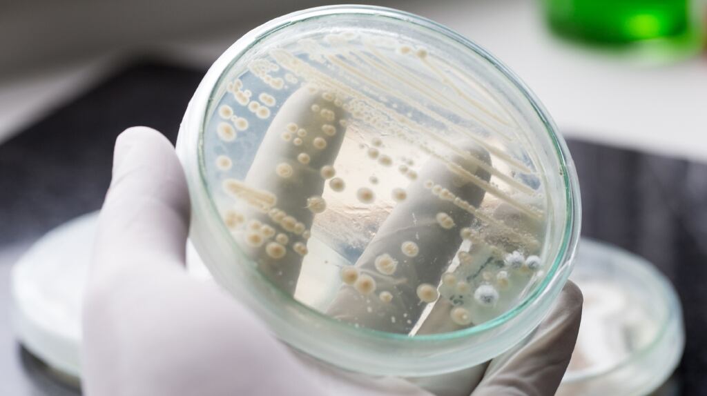 Candida auris