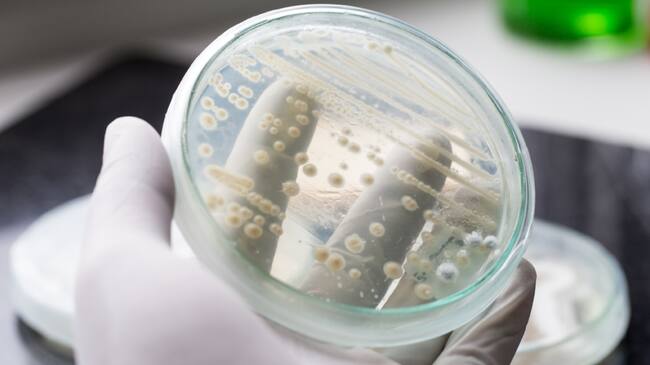 Candida auris