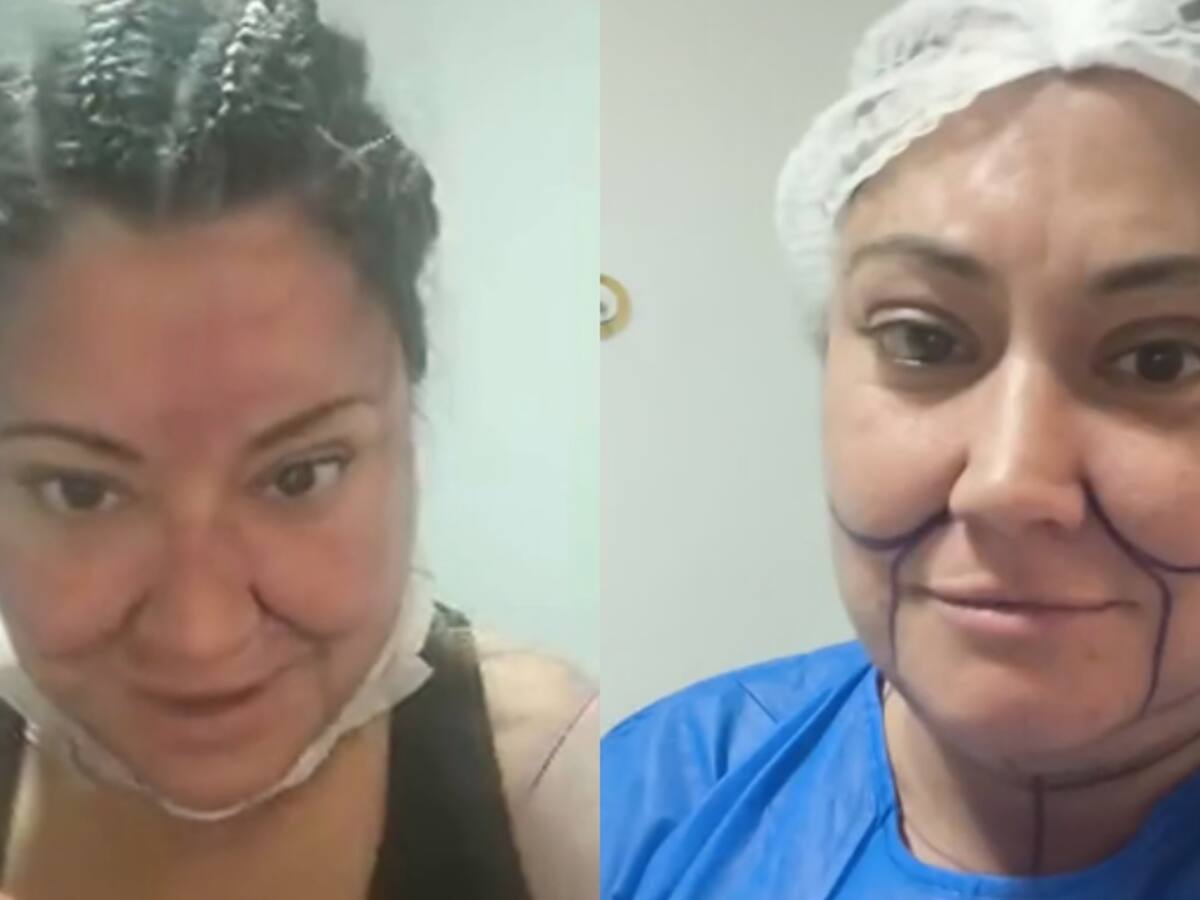 “Voy a quedar de 15”: Denisse Campos reveló detalles de sus nuevas cirugías estéticas