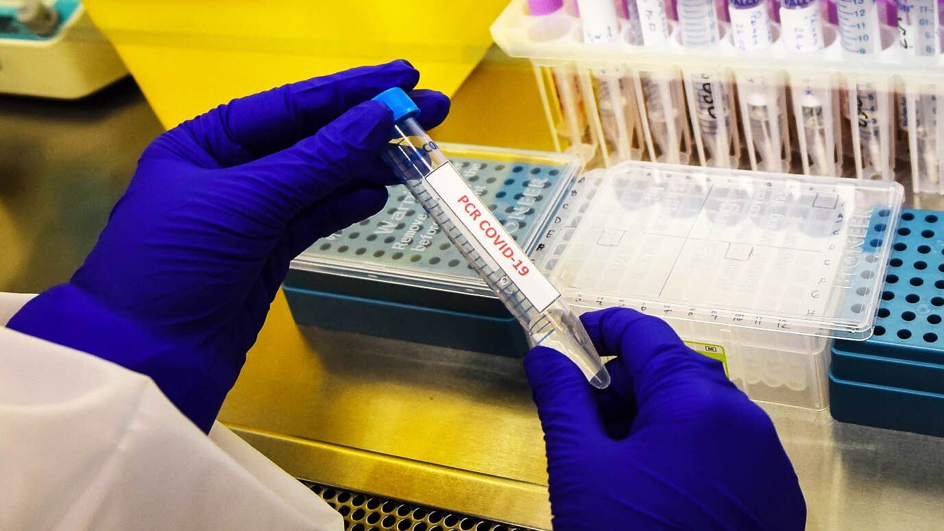 PCR Covid-19