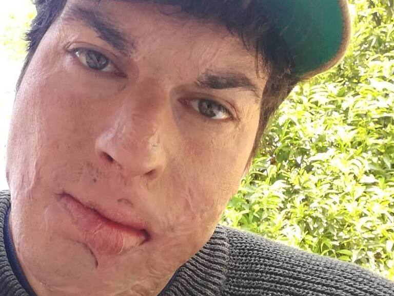 Ignacio Lastra volvió al lugar de su accidente luego de tres años