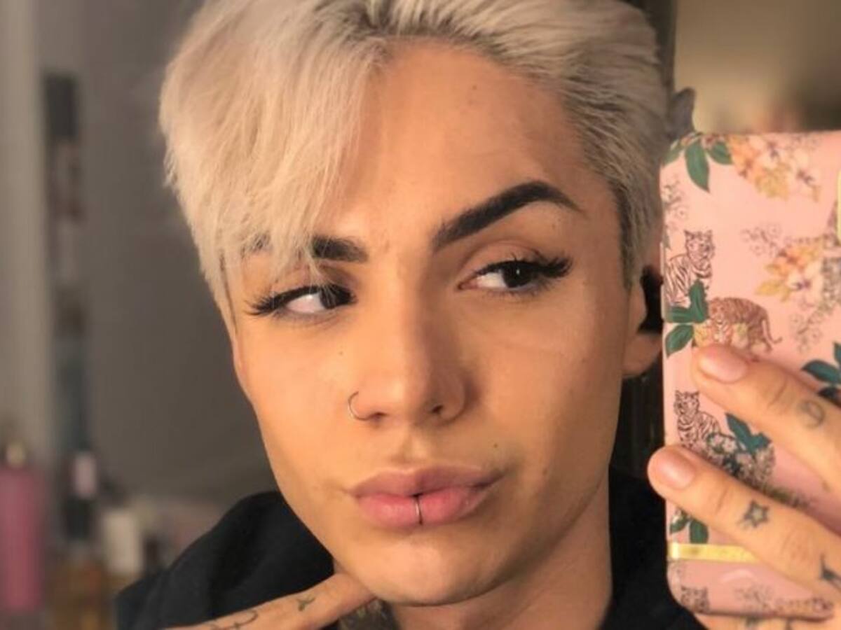 Leo Méndez Jr. sorprendió al mostrar cómo quedaron sus labios tras aumentarlos
