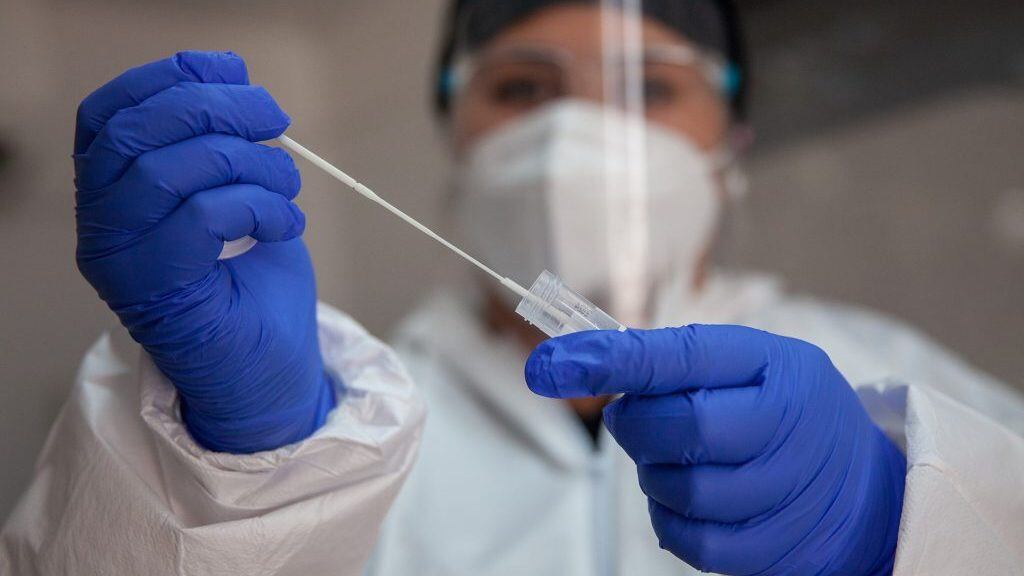 07 de Enero de 2022/SANTIAGO
Operativo exámenes PCR para la detección del Virus Covid-19 y trazabilidad. Ministerio de Salud informa 3.799 casos nuevos de COVID-19, con una positividad de 4,75% en las últimas 24 horas a nivel nacional, con 74.482 exámenes, PCR y test de antígeno.

FOTO BASTIÁN CIFUENTES /AGENCIAUNO