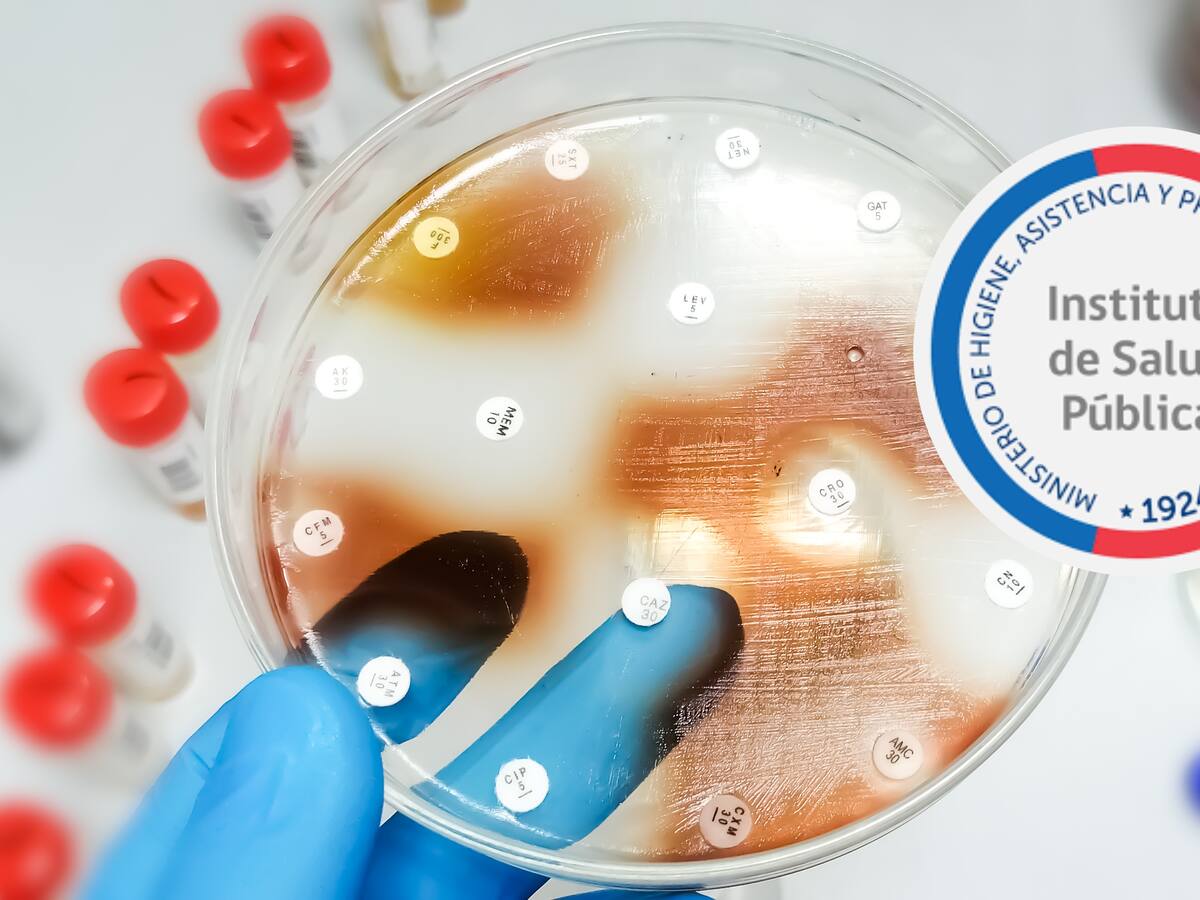 ISP ordena retiro de jabón líquido farmacéutico tras detectar peligrosa bacteria en dos pacientes