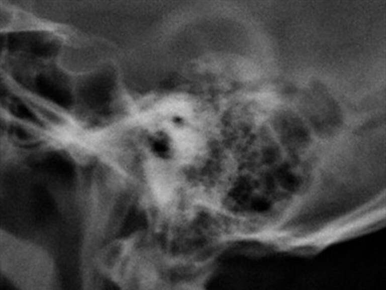 RECTIFICACIÓN: Investigación sobre nuevo hueso en el cráneo producto de los smartphones es errónea