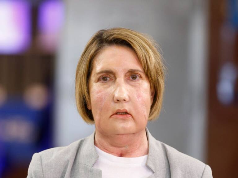 Hito en la medicina: realizan primer trasplante facial con donante que accedió a la eutanasia