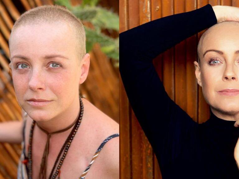 «No tengo fecha de regreso aún»: Claudia Conserva aclara el avance de su tratamiento contra el cáncer