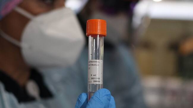 PCR coronavirus Covid-19 pandemia Chile