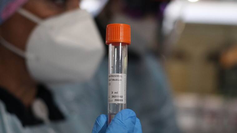 PCR coronavirus Covid-19 pandemia Chile