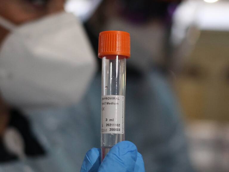 PCR coronavirus Covid-19 pandemia Chile