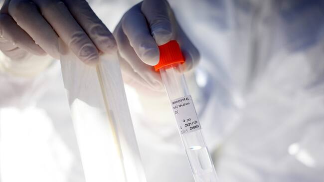 PCR coronavirus Covid-19 Chile