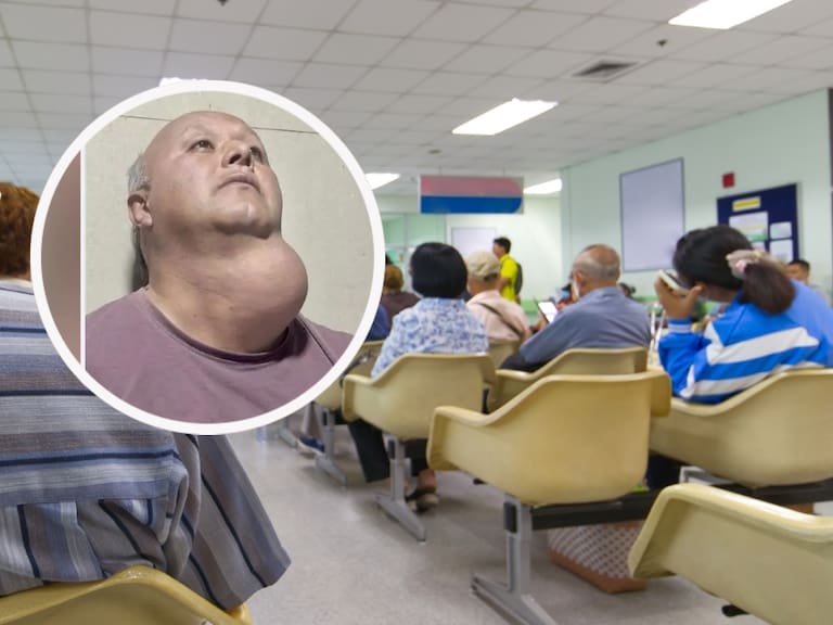 17 años esperando una cirugía por un bocio tiroideo que le impide respirar
