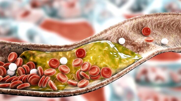 Estudio revela que hacer esta dieta por 48 horas puede reducir el colesterol hasta en 10%