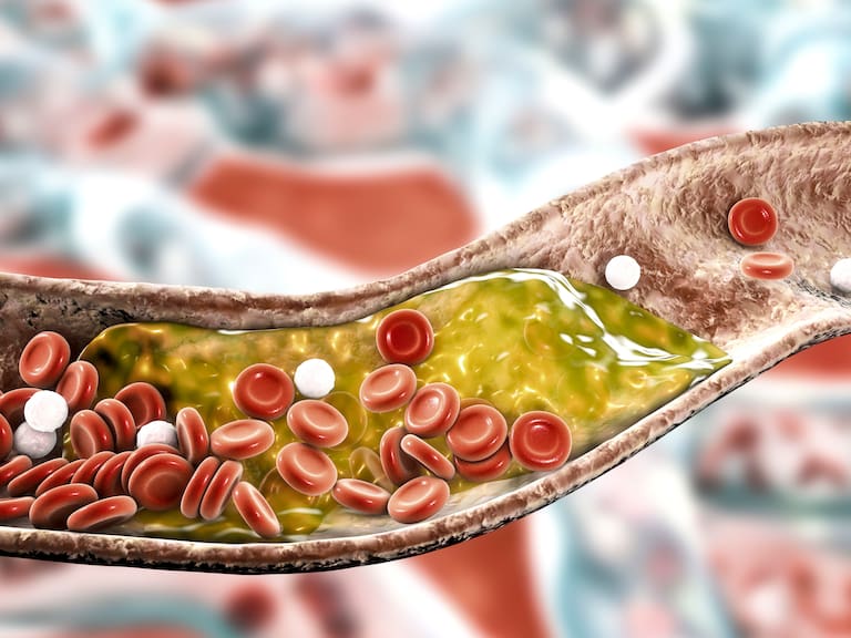 Estudio revela que hacer esta dieta por 48 horas puede reducir el colesterol hasta en 10%