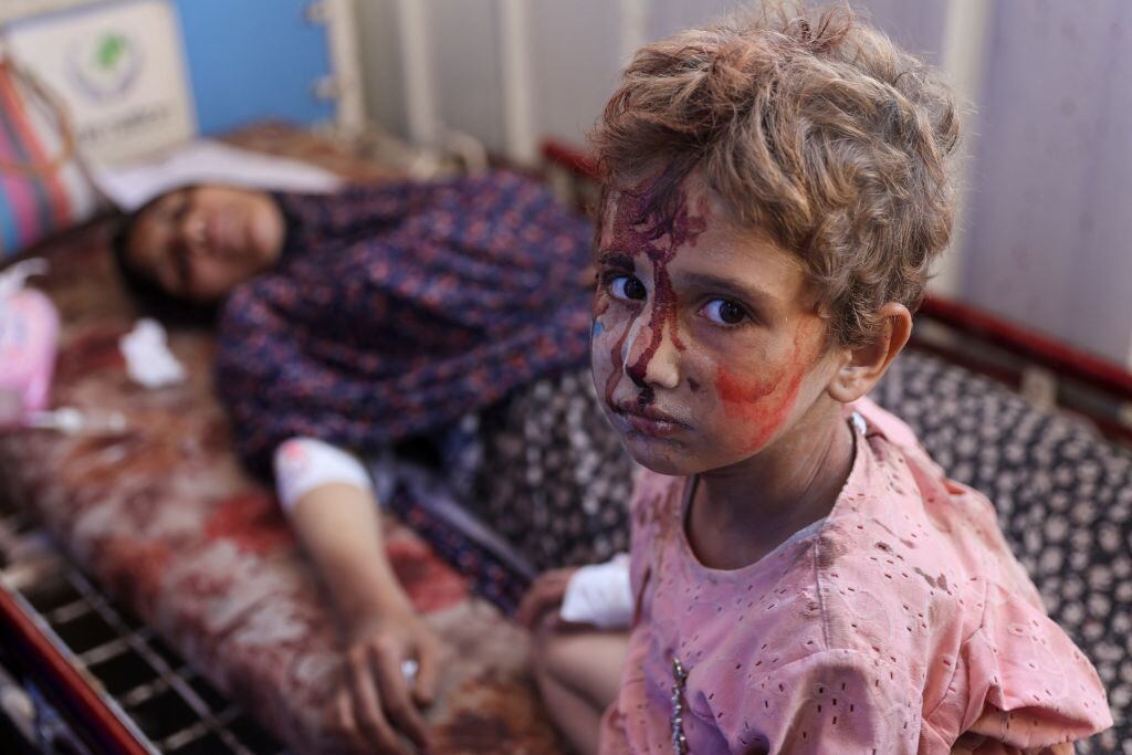 Un niño y su madre esperan atención en un hospital en la Franja de Gaza, luego de resultar heridos por un nuevo bombardeo de Israel contra el enclave palestino.