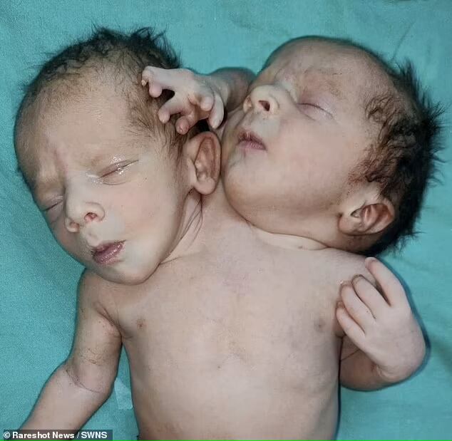 Daily Mail