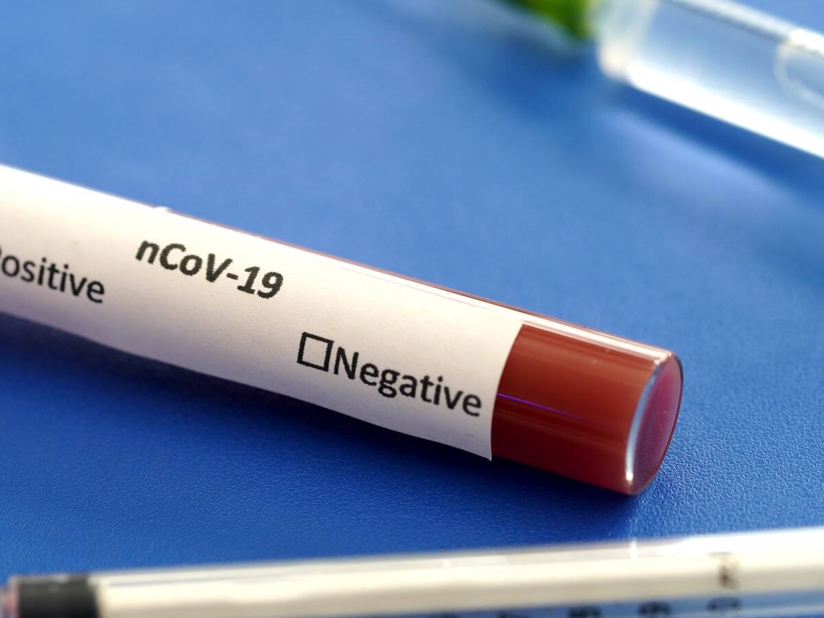 Minsal realizará testeo masivo para detectar pacientes con coronavirus asintomáticos