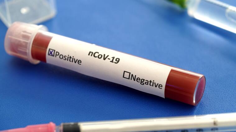 COVID19 test and laboratory sample of blood testing for diagnosis new Corona virus infection