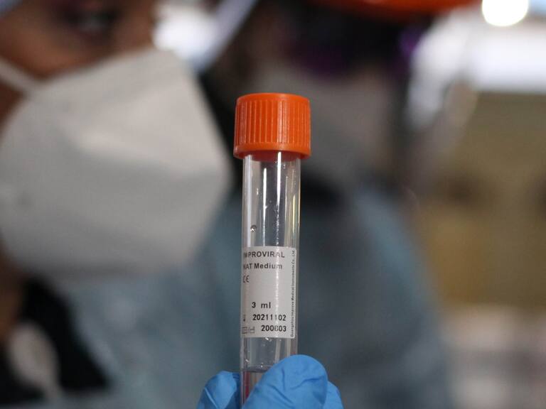 Minsal informó 1.573 nuevos casos, llegando a un total de 537.585 contagiados con Covid-19 en Chile