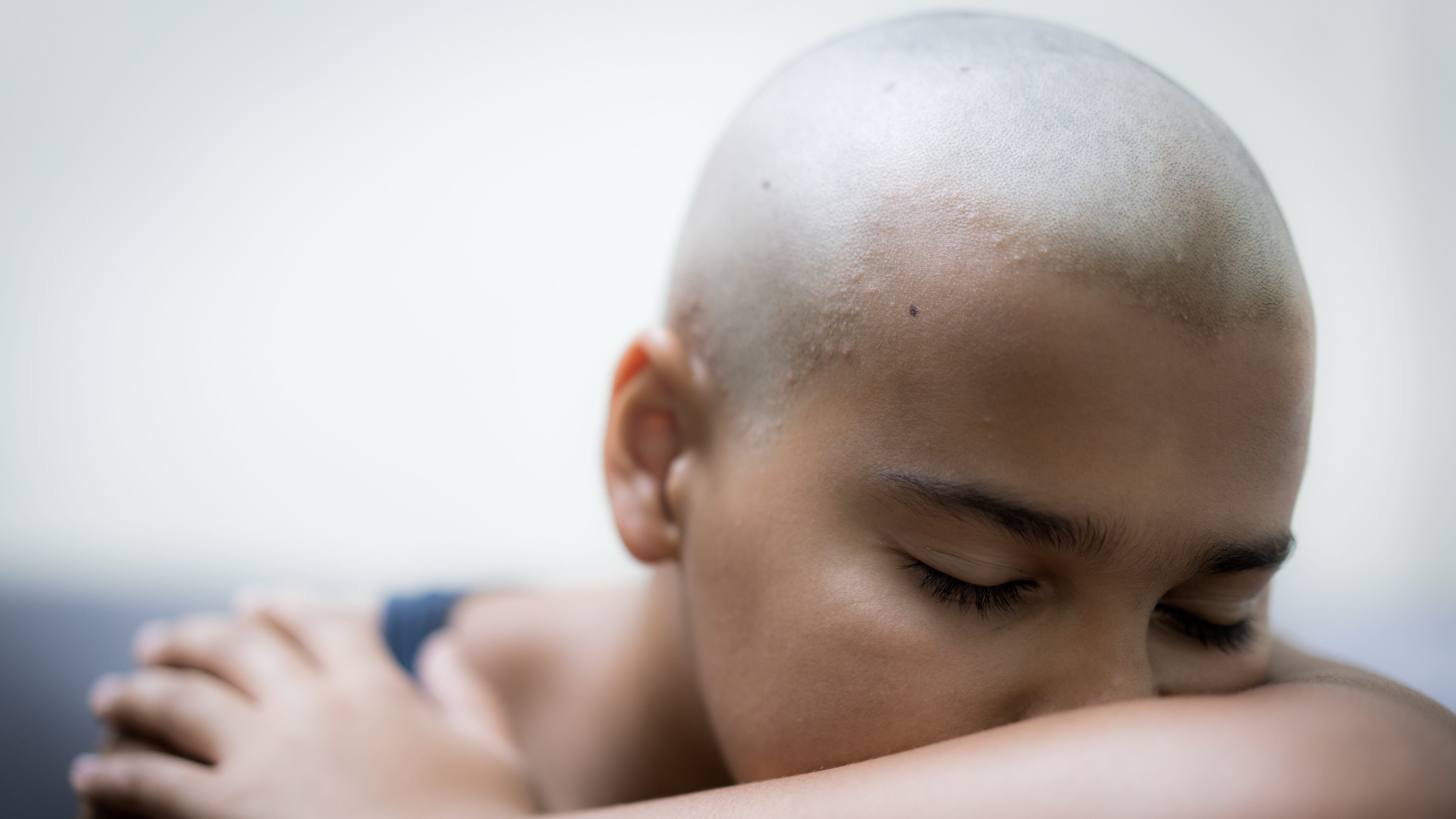 Niña con cáncer