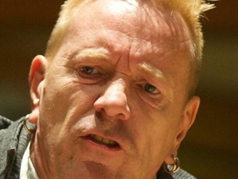 Exvocalista de Sex Pistols mostró el resultado de su sangriento show en Chile