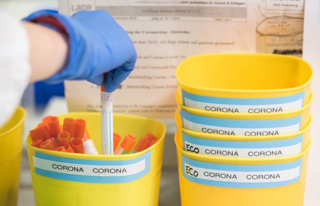 Trabajo en laboratorio para buscar soluciones al coronavirus