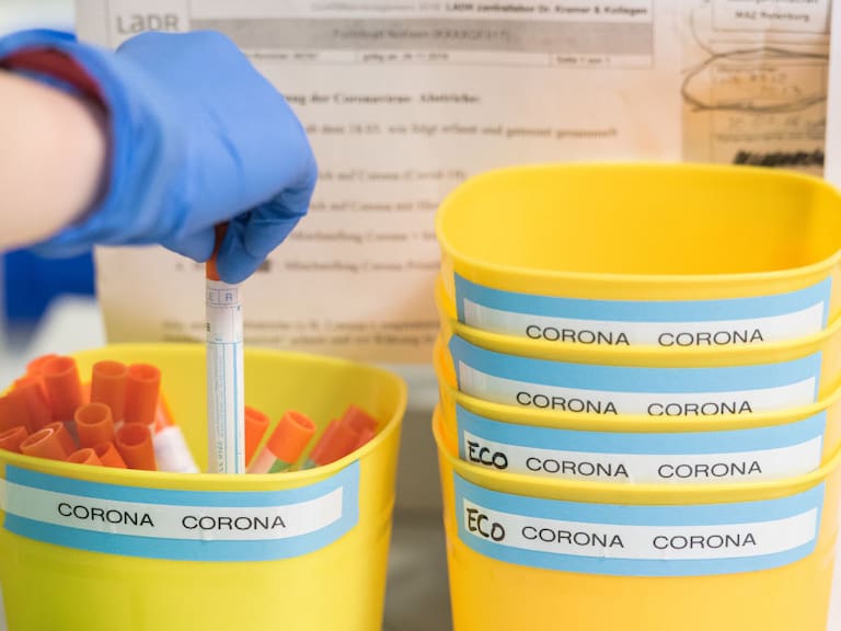 Trabajo en laboratorio para buscar soluciones al coronavirus