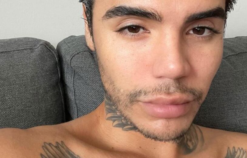 Leo Méndez Jr. operó su nariz tras recibir golpiza grupal hace dos años