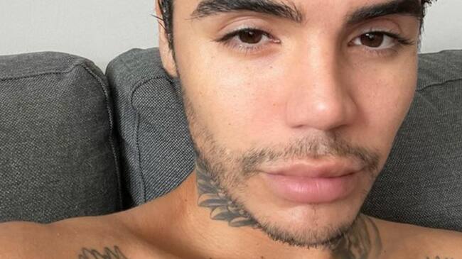 Leo Méndez Jr. operó su nariz tras recibir golpiza grupal hace dos años