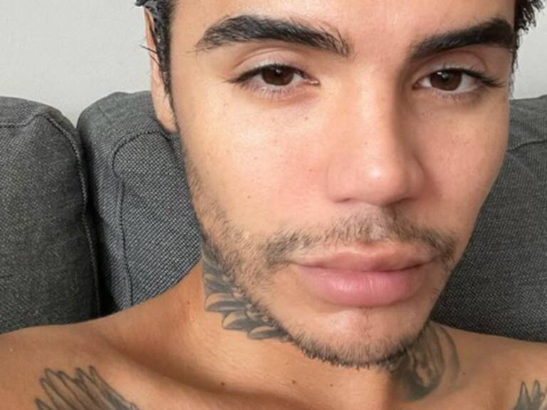 Leo Méndez Jr. operó su nariz tras recibir golpiza grupal hace dos años