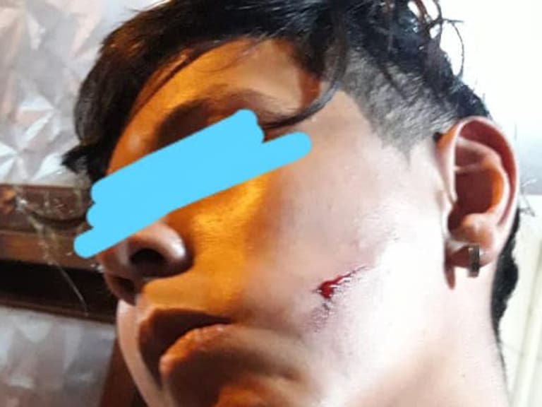 Argentina: Joven de 14 años fue golpeado por defender a amigas que estaban siendo acosadas