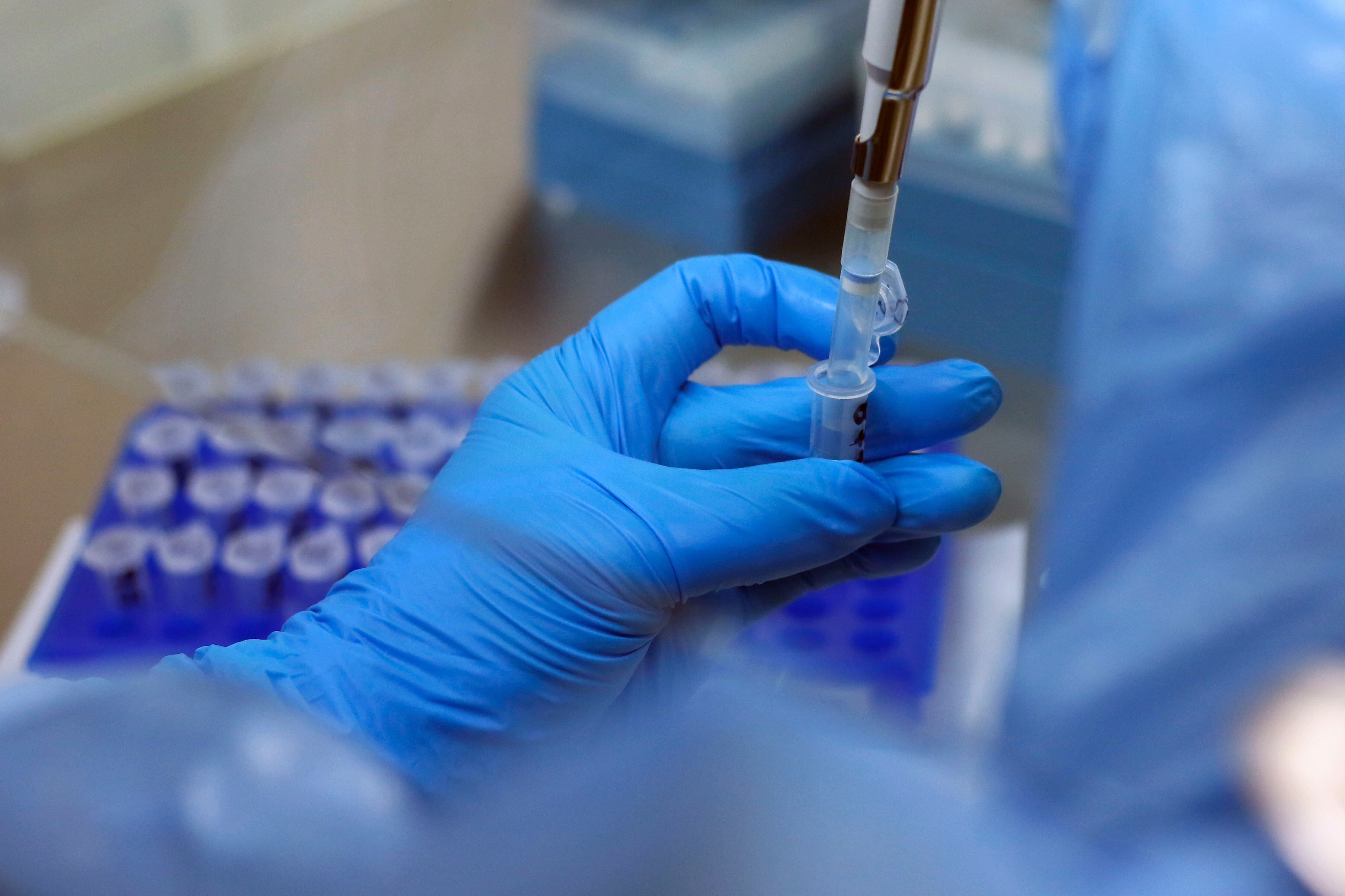 13 DE MAYO DE 2021/VALPARAISOEl Hospital Carlos van Buren inaugura un nuevo Laboratorio de Biología Molecular que fue diseñado e implementado para absorber la gran demanda de procesamiento de exámenes de PCR, entre otras labores, que generó la contingencia sanitaria por Covid-19.
FOTO: LEONARDO RUBILAR CHANDIA/AGENCIAUNO