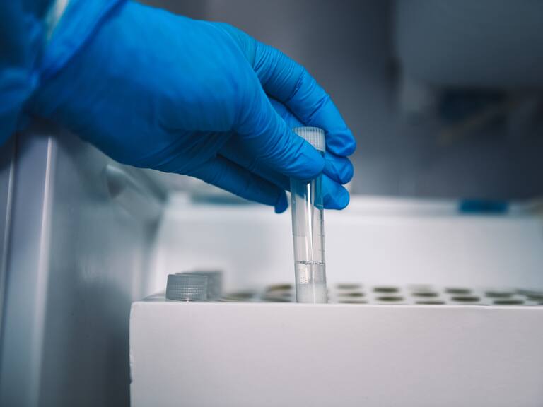 2 DE ABRIL 2021 / TEMUCO
Carro TTA contratado por Seremi de Salud que realiza cerca de 600 exámenes PCR que son analizados en el mismo lugar, entregando resultados en un tiempo máxmo de 24 horas.
FOTO: MARCOS MALDONADO / AGENCIAUNO