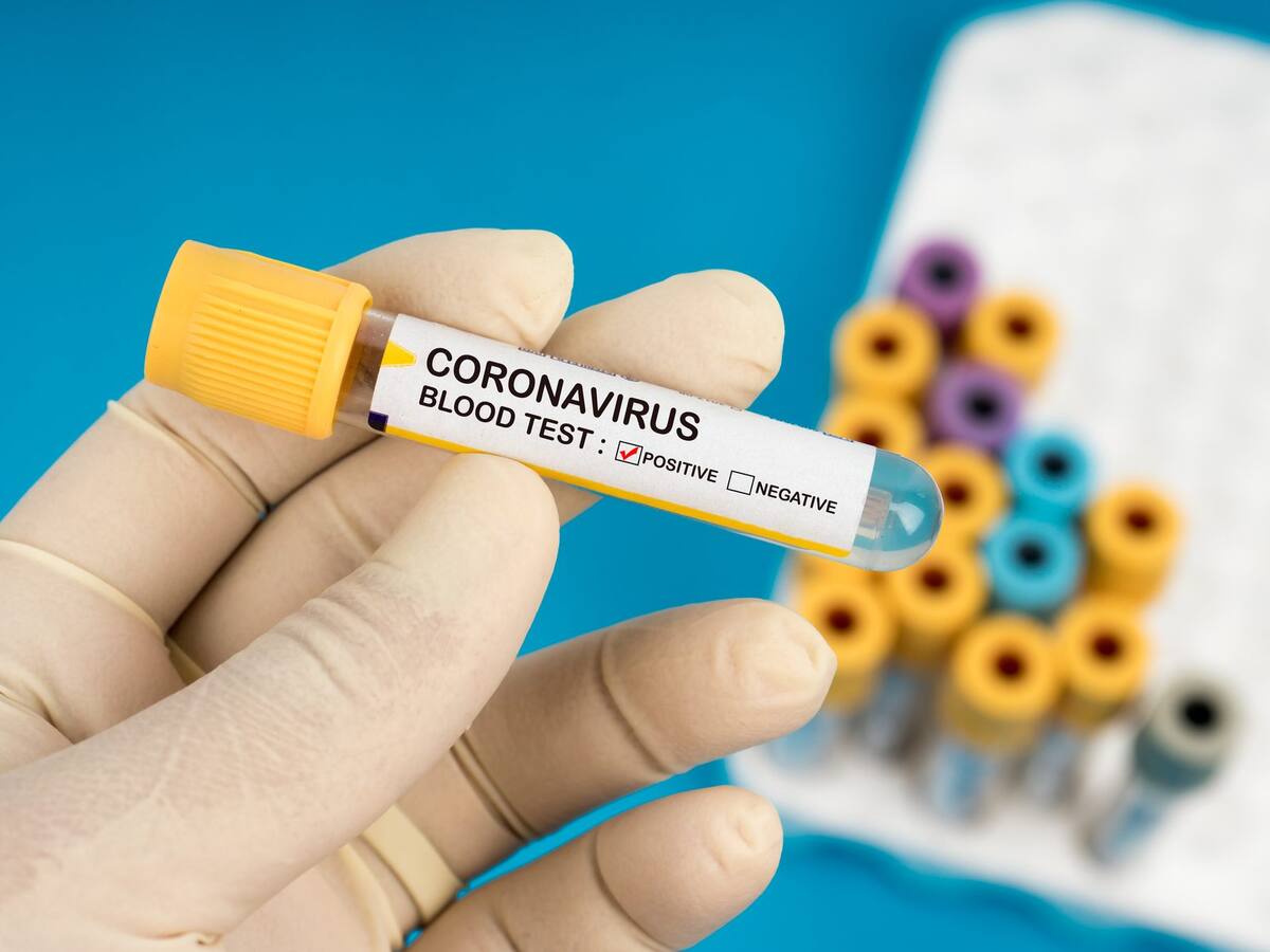 Ministerio de Salud cifró en 61 personas los contagiados por coronavirus en Chile