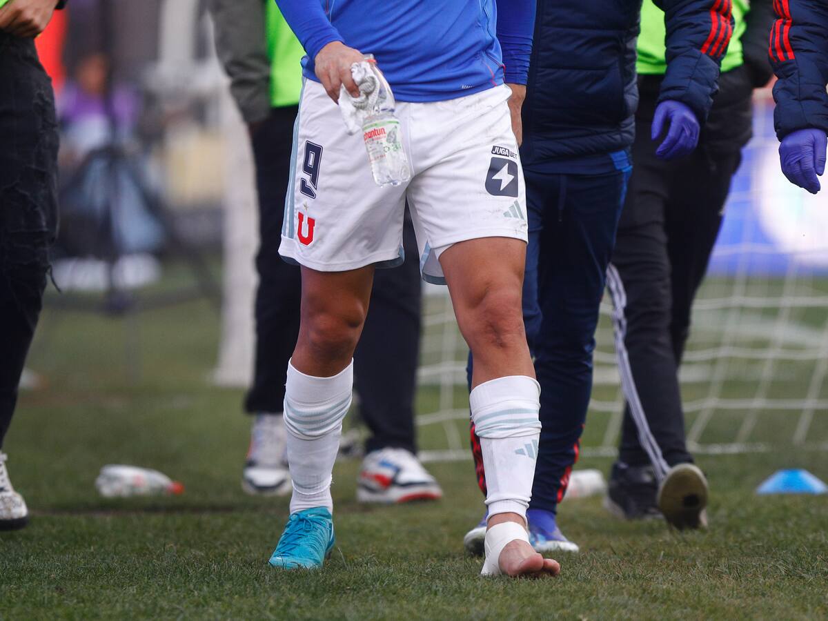 ¿Se frota las manos Colo Colo? Las sensibles bajas que sumó la U de cara al Superclásico