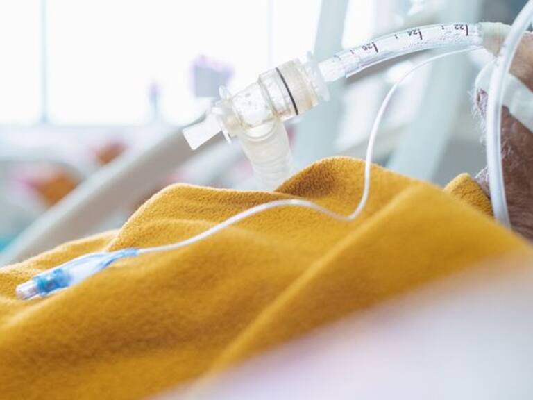 Endotrachel tube giving oxygen to illness human such pulmonary infection , respiratory failure , heart failure , operative room