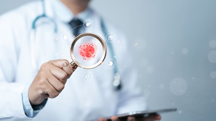 Detectar el cáncer antes de los síntomas: la nueva estrategia que se implementará en 28 comunas de Chile