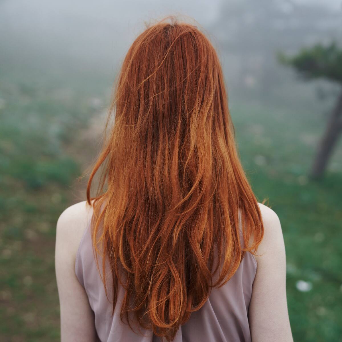 Gen asociado al cabello rojo explica por qué algunas heridas no cicatrizan, según estudio