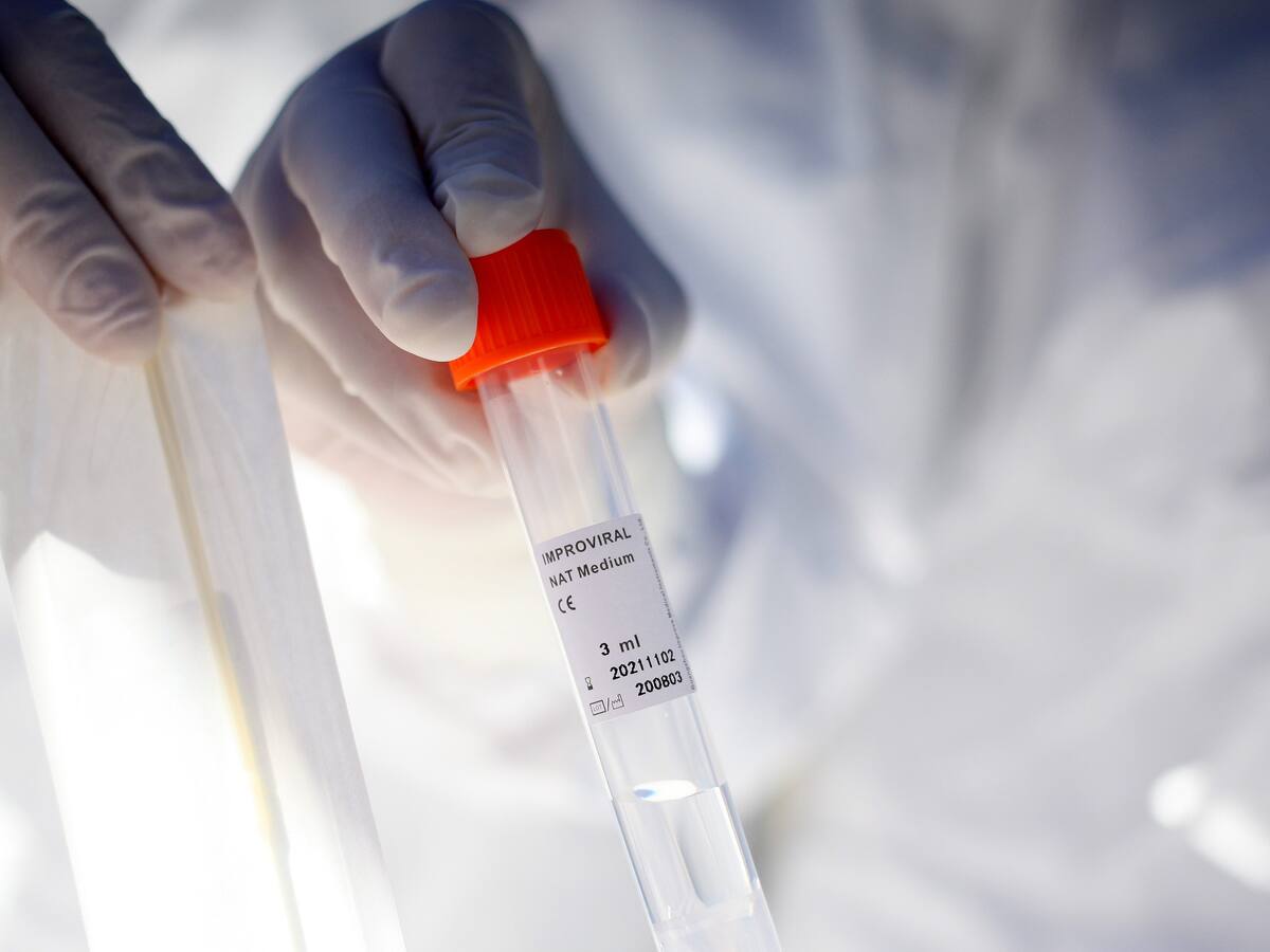Minsal informó 64 fallecidos por Covid-19 en Chile, llegando a un total de 16.724 desde el inicio de la pandemia en el país