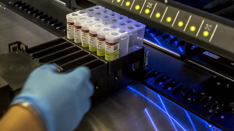 Exámenes PCR coronavirus Covid-19