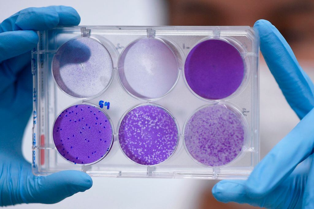 Un investigador revisa una muestras del nuevo coronavirus