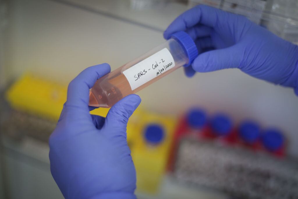 Una muestra del Covid-19 en un laboratorio de Río de Janeiro