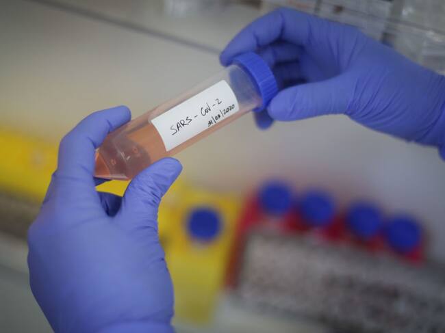 Una muestra del Covid-19 en un laboratorio de Río de Janeiro