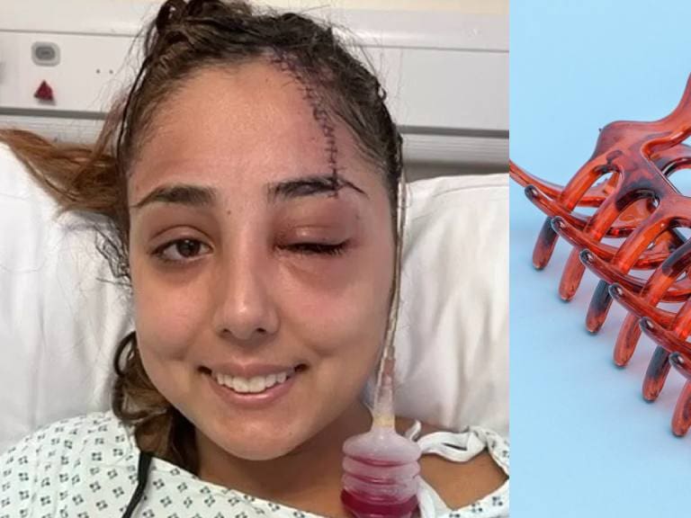 Mujer casi muere por chocar usando una pinza para el pelo